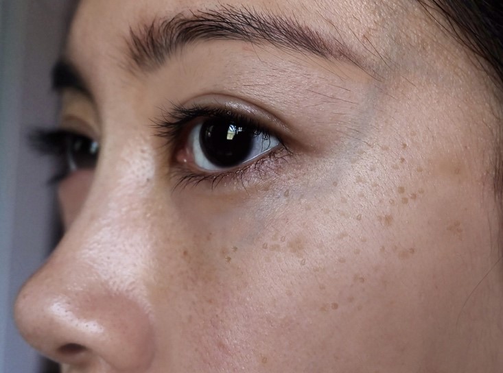 3. Brightening, Dark Spots, Uneven Skin Tone