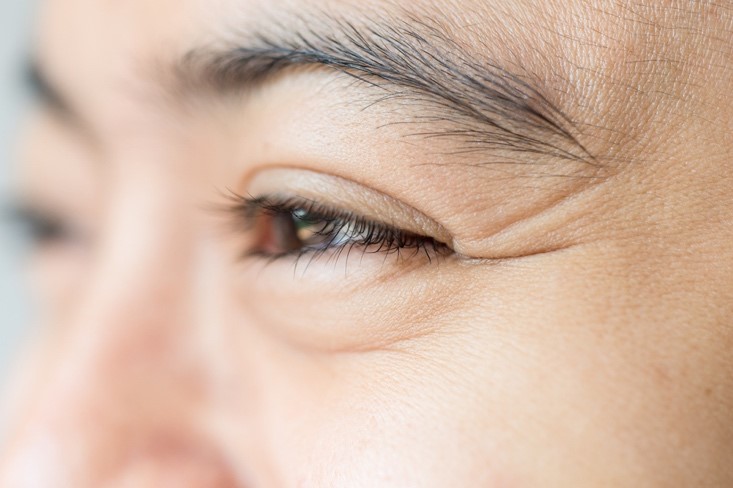 4. Early Aging Signs