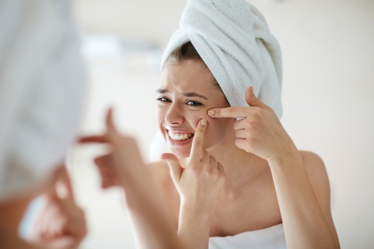 Cara Mengatasi Jerawat Hormonal